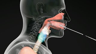 How do Straw Exercises Help the Voice Get Better voicetherapy [upl. by Anaert195]