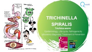 Trichinella Spiralis Parasitology simplified tutorials For NEXT USMLE NEET PG PLAB [upl. by Aynotan547]