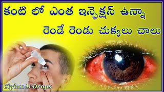 CiploxD eye drops uses in telugu  treatment for eye infection  conjectivities  telugu [upl. by Anerb]