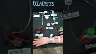 Haemodialysis working model made by our group shorts shortsfeed [upl. by Ylecara]