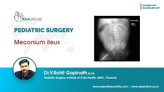 Meconium ileus PediatricSurgery Surgery Meconiumileus [upl. by Ayetal]