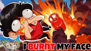 I Burnt My Face Storytime [upl. by Reifnnej]