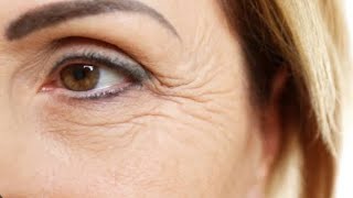 wrinkle free skin clear make younger look best medicine in homeopathymedicorcle7553 [upl. by Demahum298]