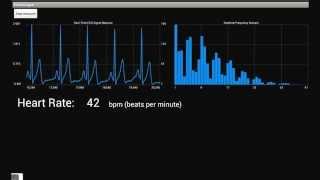 Demo ECG Signal Analysis on Android Tablet [upl. by Eelah]