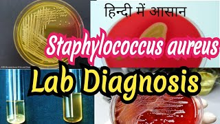 Staphylococcus aureus  Laboratory diagnosis in hindi [upl. by Zenger]