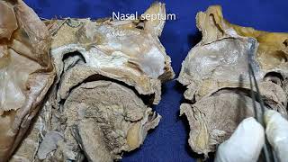 Nasal cavity and paranasal air sinuses [upl. by Delcina]