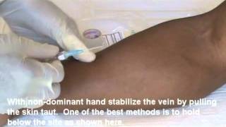 IV Insertion Video Demo 1 of 2mp4 [upl. by Adon]