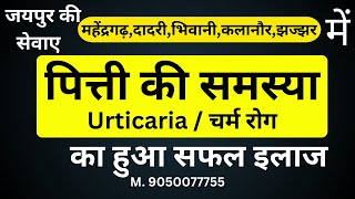 Skin Allergy  Urticaria treatment  पित्ती की समस्या का इलाज [upl. by Hirz]