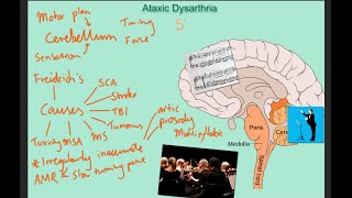 Ataxic dysarthria  samples and explanation [upl. by Assital]