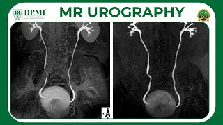 Magnetic Resonance Urography MRU MR Techniques amp Clinical Applications MIR Test amp Safety [upl. by Pippo790]