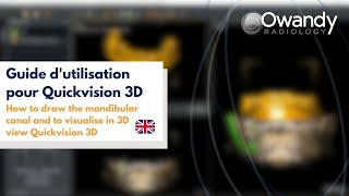 3 How to draw the mandibular canal and to visualise in 3D view Quickvision 3D [upl. by Rhianna234]