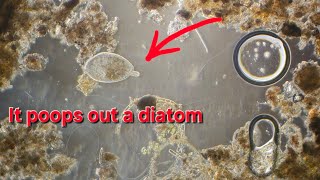 Frontonia poops out a diatom  100x [upl. by Frost310]