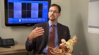 Minimally Invasive Heart Surgery with Craig Hampton MD [upl. by Ahrendt]