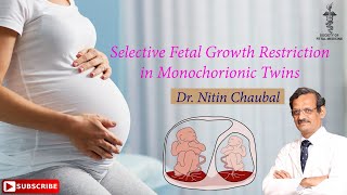 sFGR in Monochorionic Twins  Dr Nitin Chaubal [upl. by Notluf275]