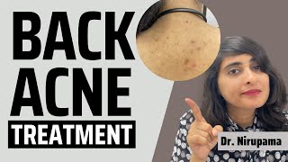 Back Acne Pimples on back Back acne treatment Back acne spots How to get rid of back acne2022 [upl. by Ettigirb]