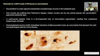 ProfDrJose Lanciego Gene therapy approaches for Parkinson’s disease [upl. by Llewellyn787]