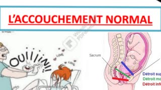 accouchement normal  dernière partie [upl. by Amehsyt]