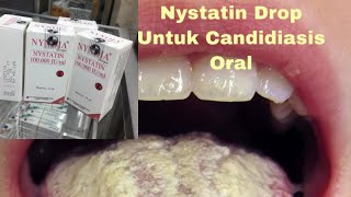 Dosis dan Cara Penggunaan Nystatin drop untuk Pengobatan sariawan dan Jamur mulut Candidiasis oral [upl. by Ashley]