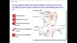 What structure is immediately dorsal to the ligamentum arteriosum [upl. by Spector]