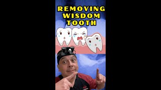 Wisdom Tooth Removal How Dentists Assess and Plan the Extraction  View Mobile Dental [upl. by Dihsar]