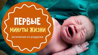 Что делают с новорожденным после родов [upl. by Tremaine]