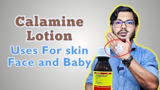 Calamine Lotion  ক্যালামাইন লোশন ব্যবহারের নিয়ম [upl. by Aramenta522]