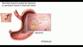 MEDICINE LECTURES  Gastrointestinal  DIARRHEA  Part 1 [upl. by Aitret439]