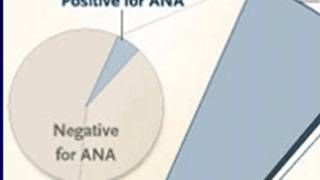 Systemic Lupus Erythematosus SLE and Anti phospholipid Antibody Syndrome APS [upl. by Ittak647]