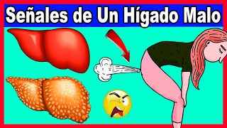 10 Signos de Hígado Enfermo pero lo Peor es que NO Todos lo Saben [upl. by Helve]