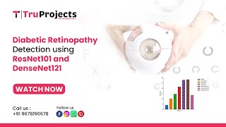 Diabetic Retinopathy Detection using ResNet101 and DenseNet121 final year btech cse projects [upl. by Nosila]