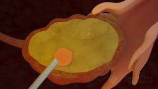 Ovulation amp the menstrual cycle  Narrated 3D animation [upl. by Annahtur]