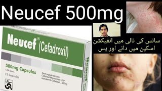 neucef 500mg capsule Cefadroxil Antibiotic Cephalosporin group ll جلد کی بیماریوں کا علاج Dentalpain [upl. by Alaet100]