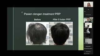 Integrative Care for Telogen Effluvium Rambut Rontok amp Alopecia Areata 2 [upl. by Dorsey]