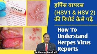 हर्पिस वायरस HSV1 amp HSV 2 की रिपोर्ट केसे पढ़े l How To Understand Herpes Virus Reports [upl. by Orelia]