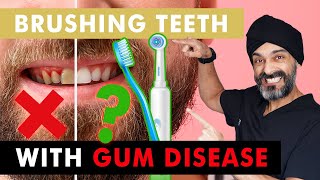 Stop Gum Disease with These Brushing Techniques [upl. by Rieger]