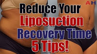 Liposuction Recovery Care  Reduce Your Liposuction Surgery Recovery Time  5 Tips [upl. by Xanthus]