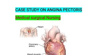 CASE STUDY ON ANGINA PECTORIS NURSING CASE STUDY ON ANGINA PECTORIS [upl. by Eelyam]