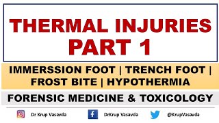 Thermal Injury  Classification  Injuries due to cold  Dr Krup Vasavda [upl. by Ordnaxela145]