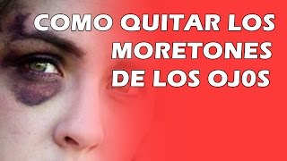 Como Quitar Los Moretones De Los Ojos [upl. by Eelyr]