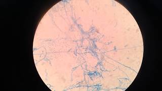 Acremonium spp [upl. by Jodie]