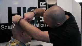 HIS Hair Clinic  New York Hair Restoration Clinic for Scalp Pigmentation Part 1 [upl. by Ardehs]