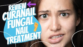 Curanail Fungal Nail Treatment  Review [upl. by Ferri]