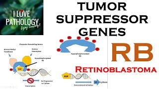 NEOPLASIA 3 TUMOR SUPPRESSOR GENES Retinoblastoma Gene Knudsons Two Hit Hypothesis [upl. by Nujra]