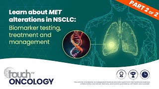 Personalized therapy for NSCLC Biomarker testing treatment and management in MET alterations [upl. by Elmo]