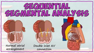 Cardiac Morphology Using Sequential Segmental Analysis [upl. by Ramal114]