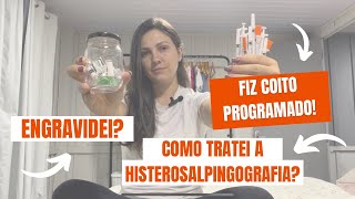 Histerosalpingografia  Indução de Ovulação com Menopur [upl. by Whitelaw]