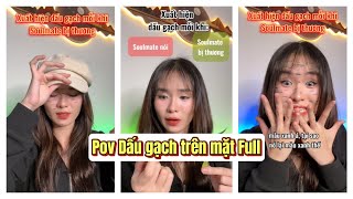 Lý Nguyễn Nhi  Pov Dấu gạch trên mặt Full [upl. by Frederica956]