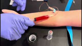 HOW TO PERFORM A VENIPUNCTURE USING A SYRINGE  PHLEBOTOMY 2024 [upl. by Julis]