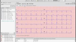 CardioPerfect Patient  ECGwmv [upl. by Eidassac]