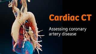 Cardiology How CT imaging captures the rhythm of the human heart [upl. by Carmelia]